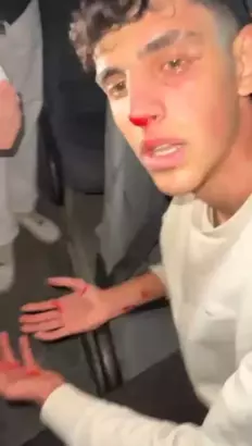 U-18 macında bir futbolcu yaralandı.